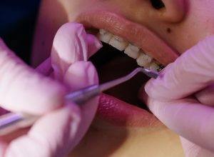 The Ultimate Guide to the Different Types of Dental Services