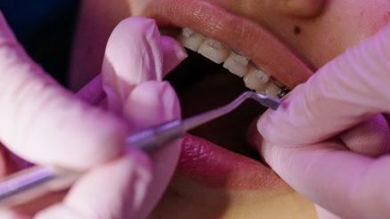 The Ultimate Guide to the Different Types of Dental Services