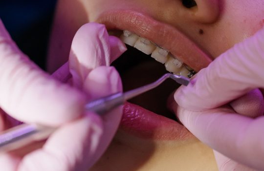 The Ultimate Guide to the Different Types of Dental Services The Ultimate Guide to the Different Types of Dental Services