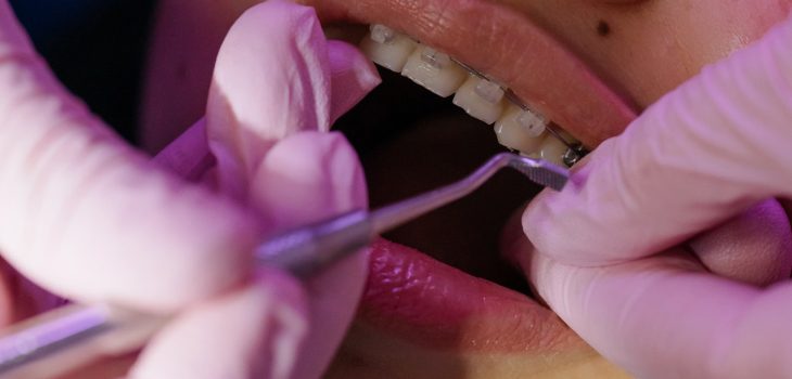 The Ultimate Guide to the Different Types of Dental Services