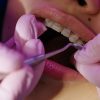 The Ultimate Guide to the Different Types of Dental Services